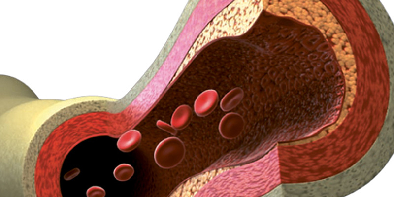 Vitamin K2 supplementation and arterial stiffness among renal transplant recipients—a single-arm, single-center clinical trial
